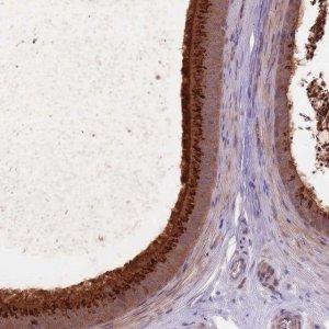 Anti-EDDM3A antibody produced in rabbit 