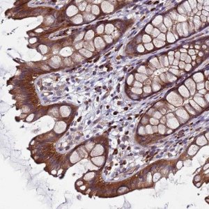 Anti-EFCAB8 antibody produced in rabbit 