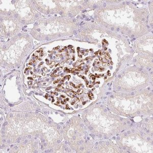 Anti-EHD3 antibody produced in rabbit 
