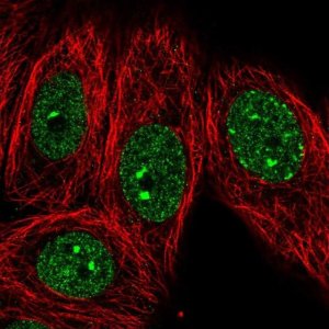 Anti-EHMT1 antibody produced in rabbit 