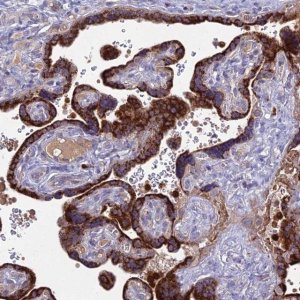 Anti-EID2 antibody produced in rabbit 