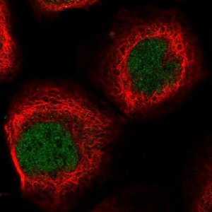 Anti-EID2 antibody produced in rabbit 