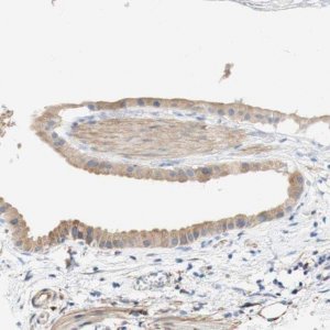 Anti-EIF2AK4 antibody produced in rabbit HPA011811-100UL
