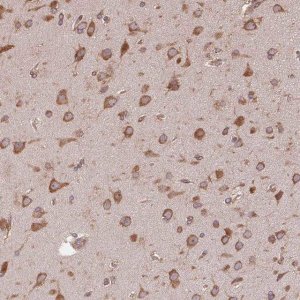 Anti-EIF2S1 antibody produced in rabbit 