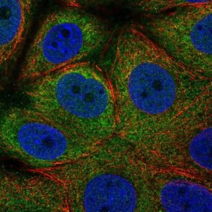 Anti-EIF2S1 antibody produced in rabbit 