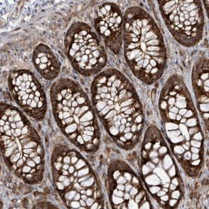 Anti-EIF3C antibody produced in rabbit 