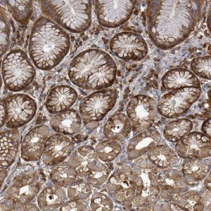 Anti-EIF3C antibody produced in rabbit HPA049495-100UL