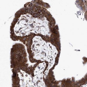Anti-EIF3M antibody produced in rabbit HPA031063-100UL