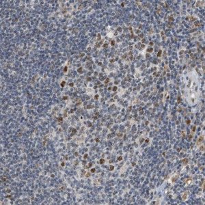 Anti-ELAC2 antibody produced in rabbit 