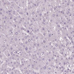 Anti-ELOVL3 antibody produced in rabbit 