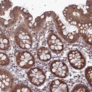 Anti-ELOVL6 antibody produced in rabbit 