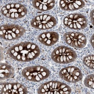 Anti-ELOVL7 antibody produced in rabbit 