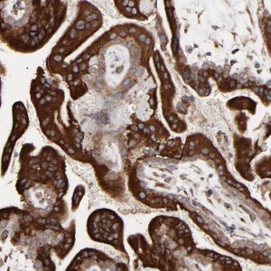 Anti-ELP2 antibody produced in rabbit 