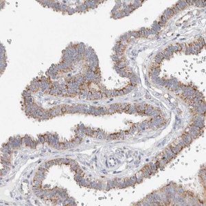 Anti-ELP3 antibody produced in rabbit 