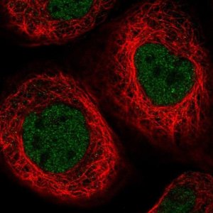 Anti-ELP4 antibody produced in rabbit HPA038572-100UL