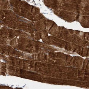 Anti-ELP5 antibody produced in rabbit 