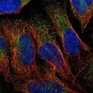 Anti-ELP5 antibody produced in rabbit 