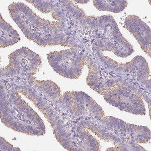 Anti-EMC6 antibody produced in rabbit HPA062681-100UL