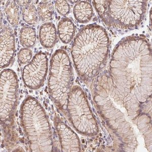 Anti-EMC6 antibody produced in rabbit HPA062681-100UL