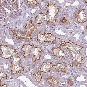 Anti-EME2 antibody produced in rabbit 