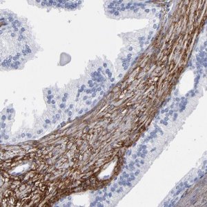 Anti-EMILIN1 antibody produced in rabbit 