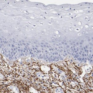 Anti-EMILIN1 antibody produced in rabbit 