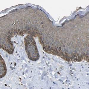 Anti-EML2 antibody produced in rabbit HPA012757-100UL