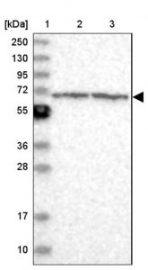 Anti-ENO4 antibody produced in rabbit HPA037938-100UL