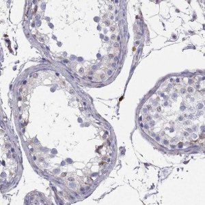Anti-ENOX1 antibody produced in rabbit 
