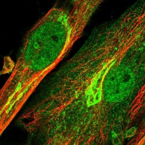 Anti-ENPP2 antibody produced in rabbit 