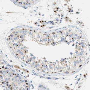 Anti-ENTPD4 antibody produced in rabbit 