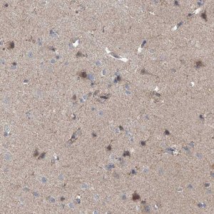 Anti-EOMES antibody produced in rabbit 