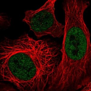 Anti-EP400 antibody produced in rabbit 