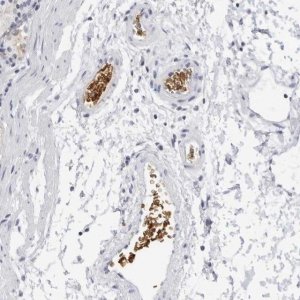 Anti-EPB41 antibody produced in rabbit 