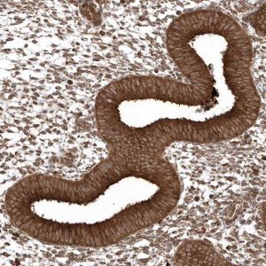 Anti-EPC2 antibody produced in rabbit 