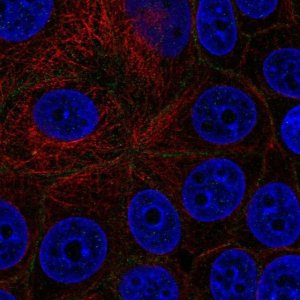 Anti-EPCAM antibody produced in rabbit 
