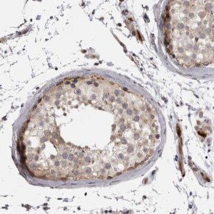 Anti-EPHA10 antibody produced in rabbit 