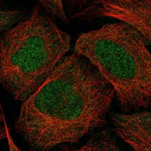 Anti-EPHA6 antibody produced in rabbit 