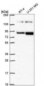 Anti-EPHB2 antibody produced in rabbit HPA071200-100UL