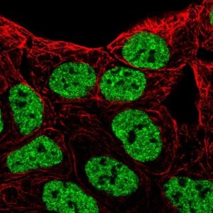 Anti-EPHB6 antibody produced in rabbit 