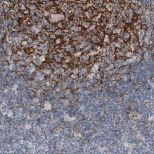 Anti-EPHX2 antibody produced in rabbit 