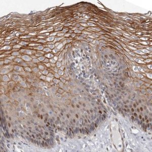 Anti-EPHX3 antibody produced in rabbit 