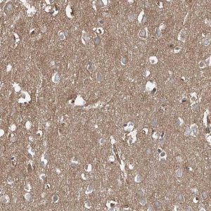 Anti-EPHX4 antibody produced in rabbit 