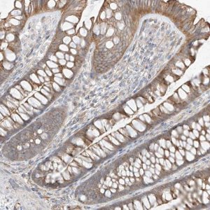 Anti-EPHX4 antibody produced in rabbit 