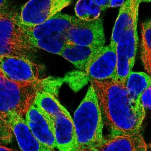 Anti-EPN1 antibody produced in rabbit 