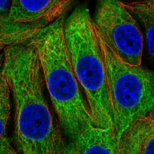Anti-EPPK1 antibody produced in rabbit 