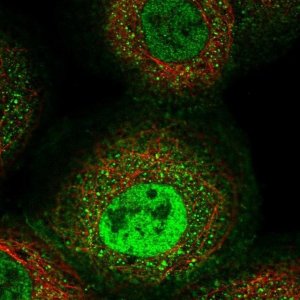 Anti-ERAP1 antibody produced in rabbit 