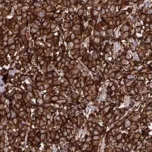 Anti-ERBB2 antibody produced in rabbit 