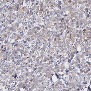 Anti-ERBB2 antibody produced in rabbit 