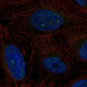Anti-ERCC6 antibody produced in rabbit 